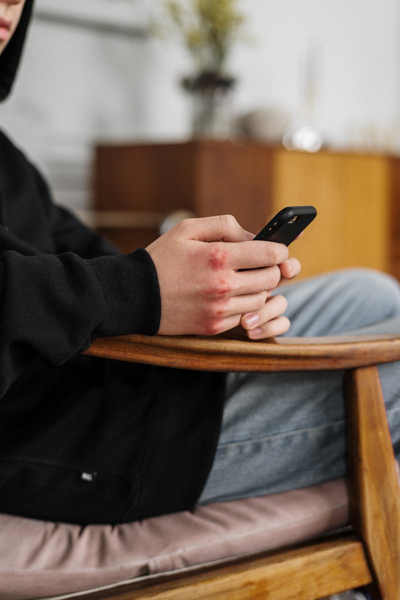 Teenager with bruised knuckles using smartphone indoors, showcasing cyberbullying concern.